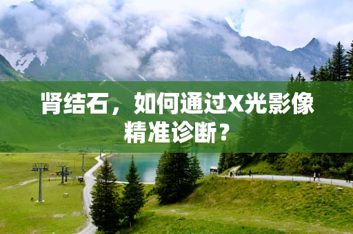 肾结石，如何通过X光影像精准诊断？