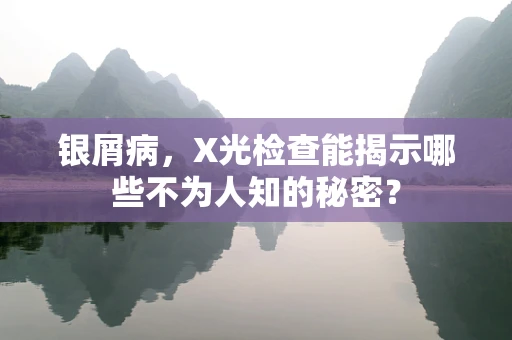 银屑病，X光检查能揭示哪些不为人知的秘密？
