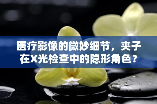 医疗影像的微妙细节，夹子在X光检查中的隐形角色？