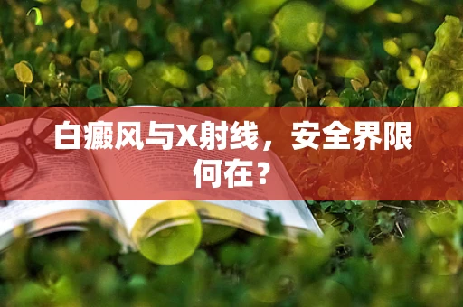 白癜风与X射线，安全界限何在？
