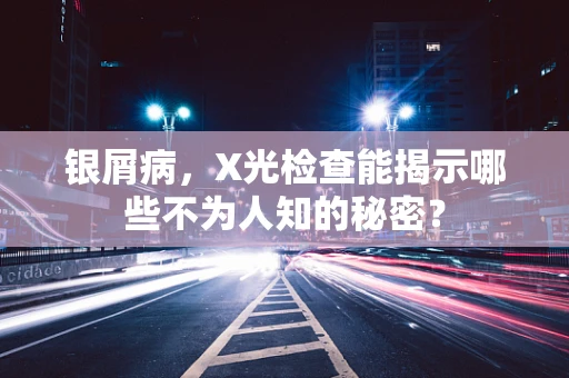 银屑病，X光检查能揭示哪些不为人知的秘密？