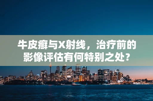 牛皮癣与X射线，治疗前的影像评估有何特别之处？