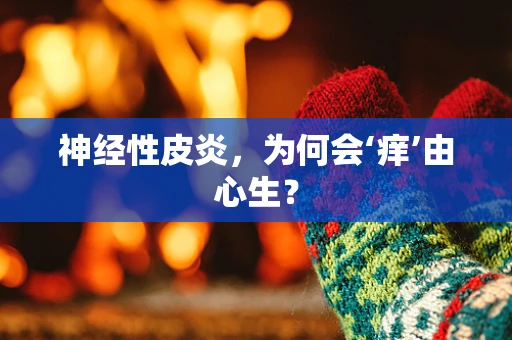 神经性皮炎，为何会‘痒’由心生？