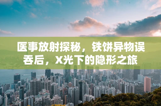 医事放射探秘，铁饼异物误吞后，X光下的隐形之旅