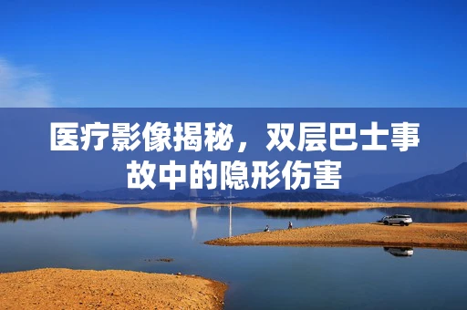 医疗影像揭秘，双层巴士事故中的隐形伤害