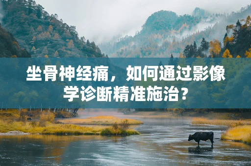 坐骨神经痛，如何通过影像学诊断精准施治？