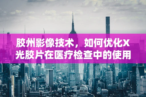 胶州影像技术，如何优化X光胶片在医疗检查中的使用？