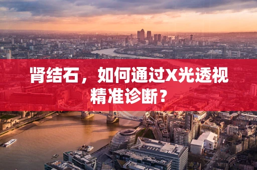 肾结石，如何通过X光透视精准诊断？