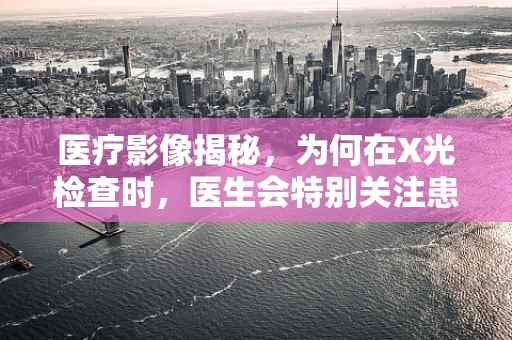 医疗影像揭秘，为何在X光检查时，医生会特别关注患者的皮带位置？