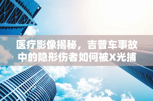 医疗影像揭秘，吉普车事故中的隐形伤者如何被X光捕捉？
