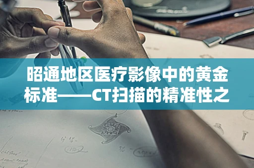 昭通地区医疗影像中的黄金标准——CT扫描的精准性之问