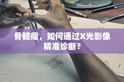骨髓瘤，如何通过X光影像精准诊断？
