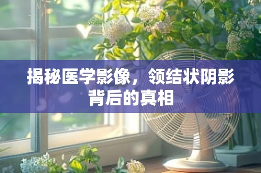 揭秘医学影像，领结状阴影背后的真相