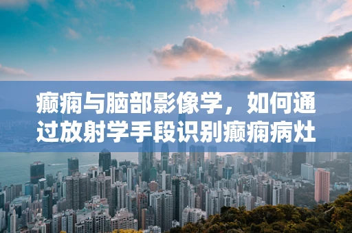 癫痫与脑部影像学，如何通过放射学手段识别癫痫病灶？