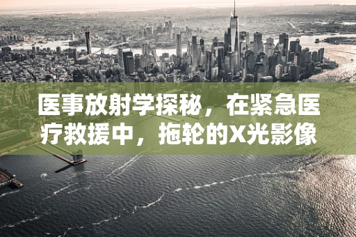 医事放射学探秘，在紧急医疗救援中，拖轮的X光影像解读关键性何在？