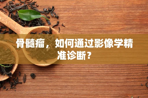 骨髓瘤，如何通过影像学精准诊断？
