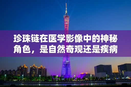 珍珠链在医学影像中的神秘角色，是自然奇观还是疾病标志？