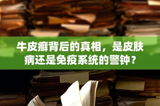 牛皮癣背后的真相，是皮肤病还是免疫系统的警钟？