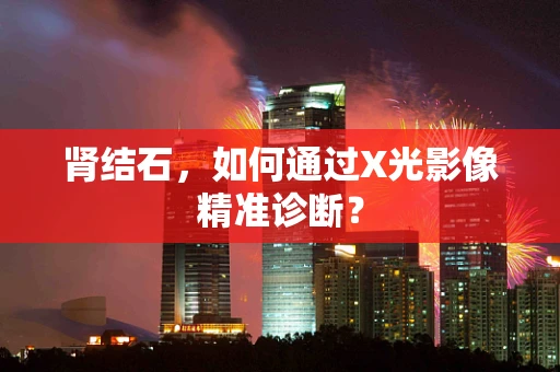 肾结石，如何通过X光影像精准诊断？