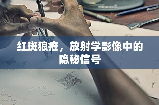 红斑狼疮，放射学影像中的隐秘信号